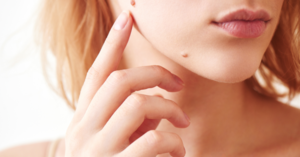 Image blog grains de beauté
